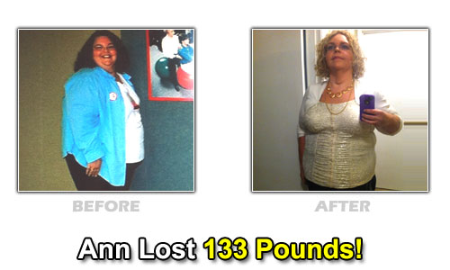 Weight Loss Stories – Ann Johnson Lost 133 Pounds and 14 Sizes