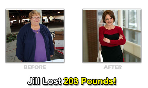 Weight Loss Stories – Jill Vento Lost 203 Pounds in 18 Months