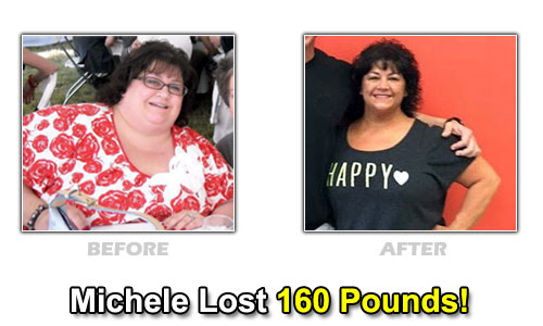 Weight Loss Stories – Michele Lost 160 Pounds and 12 Sizes