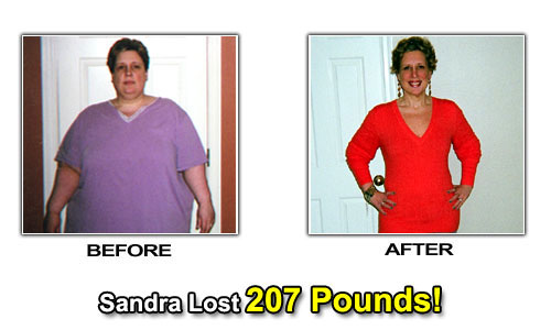 Weight Loss Stories – Sandra Rosano Lost 207 Pounds