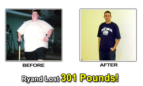 Weight Loss Stories – Ryand Lost 301 Pounds and 30 Sizes