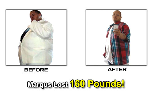 Weight Loss Stories – Marqus Lost 160 Pounds and 41 Inches