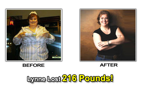 Weight Loss Stories – Lynne Lost 216 Pounds in 24 Months