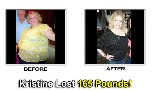 Weight Loss Stories – Kristine Lost 165 Pounds and 20 Sizes