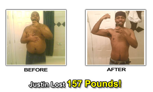 Weight Loss Stories – Justin Suggs Lost 157 Pounds