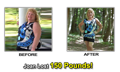 Weight Loss Stories – Joan Minnery Lost 150 Pounds