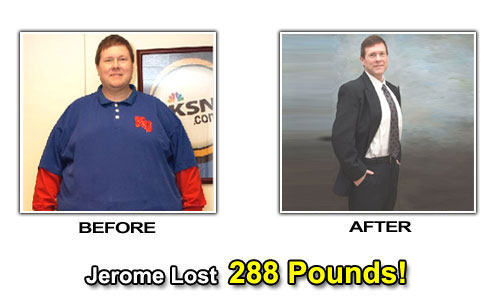 Weight Loss Stories – Jerome Lost 288 Pounds