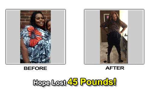 Weight Loss Stories – Hope Lost 45 Pounds in 4 Months