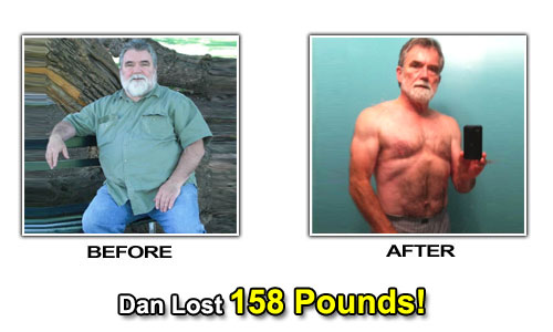 Weight Loss Stories – Dan Moffett Lost 158 Pounds