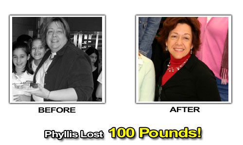 Weight Loss Stories – Phyllis Lost 100 Pounds in 18 Months