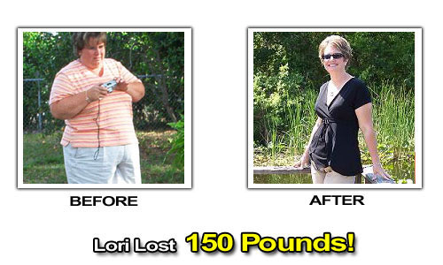 Weight Loss Stories – Lori Lost 150 Pounds in 26 Months