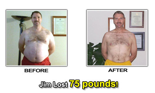 Weight Loss Stories – Jim Lost 75 Pounds and 16 Inches