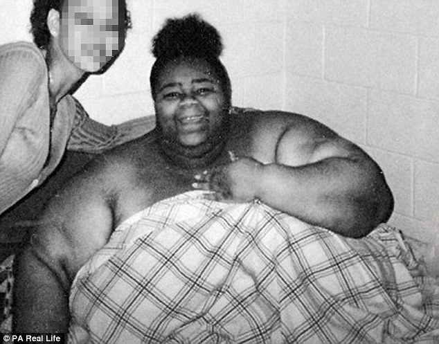 1,000 Pound Woman Loses Half Her Weight: “I’m So Much Happier Now”