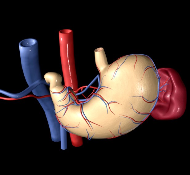 Q&A: Is Gastric Bypass Surgery Safe?