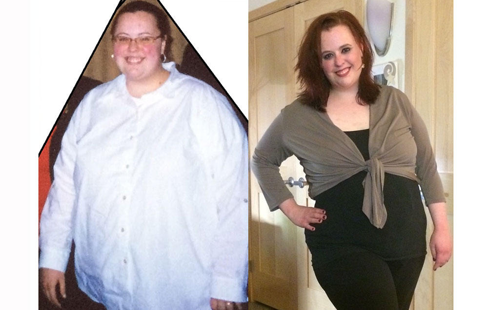 My Weight Loss Surgery Was a Huge Mistake  