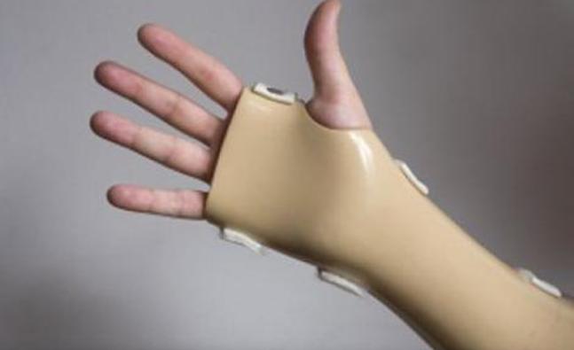 Weight gain and carpal tunnel syndrome