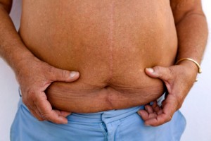 Age Related Obesity: Brown Fat Fights Belly Fat