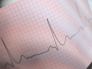 Cardiac sarcoidosis raises arrhythmia and heart failure risk