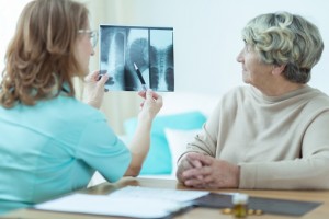 Celiac disease increases osteoporosis and bone fracture risk