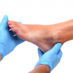 Foot Health Awareness Month, diabetes foot complications, gangrene, sprained ankle, and smelly feet