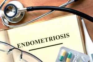 Endometriosis pelvic pain in women associated with poor mental health