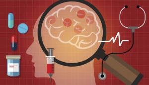 Multiple sclerosis vs. Parkinson’s disease, differences in symptoms, causes, and treatment