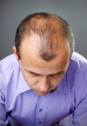 Latest Hair Loss Theory Turns Everything Upside Down