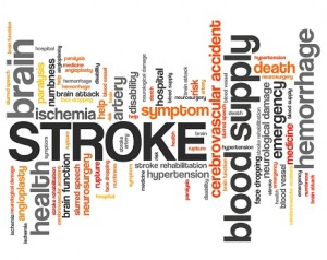 Stroke survivors face long-term memory loss, cognitive function decline