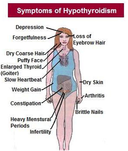 Is Your Thyroid Making You Fat ?