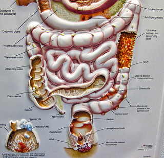 Put An End To Hemorrhoid Discomfort With These Simple Tips