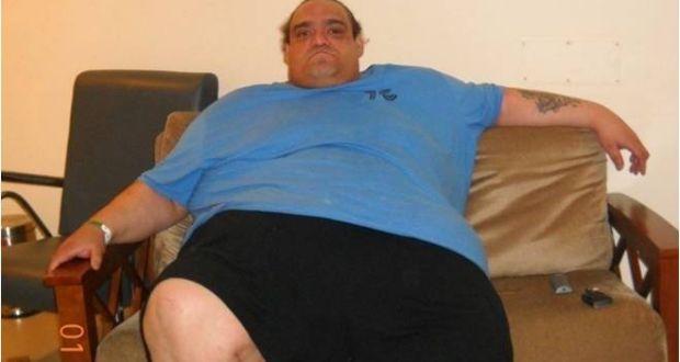 ‘Heaviest’ British man sheds record weight in India!