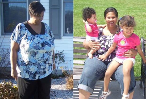 One Womans Amazing 155-Pound Weight Loss Story