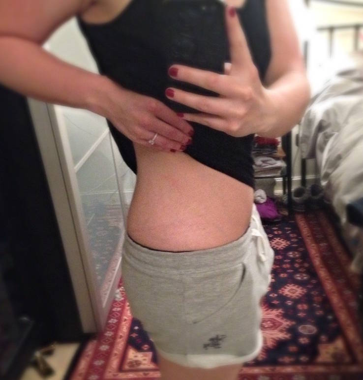 How I Learned To Love My Stretch Marks