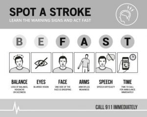 Warning signs to spot a stroke FAST